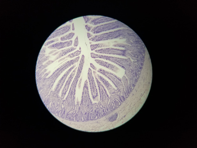 Simple Columnar Epithelium Slides - Simple Columnar Epithelium 02 100X
